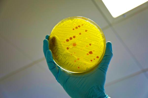 Microplastic pollution can fuel rise in&hellip;