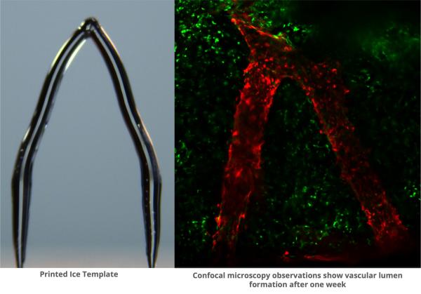 photo of New 3D printing method uses ice to build a template for artificial blood vessels in engineered tissue image