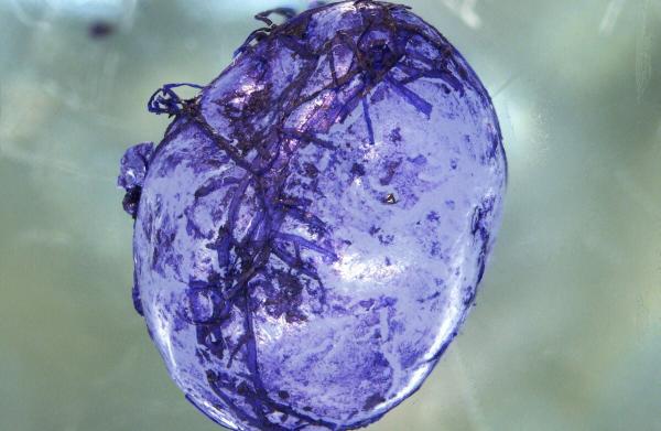 Study: Tiny bacteria could ‘eat’…