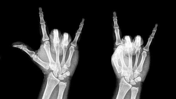 How To Recycle X-Ray Film