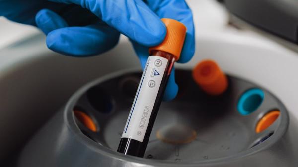 'Forever chemicals' found in 98.8% of&hellip;