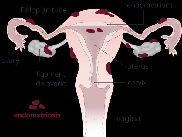 Waterways to wombs: threats of plastic…