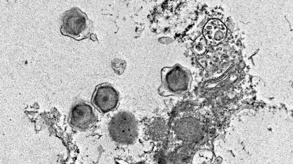 photo of Scientists uncover 230 giant ocean viruses that hijack photosynthesis image