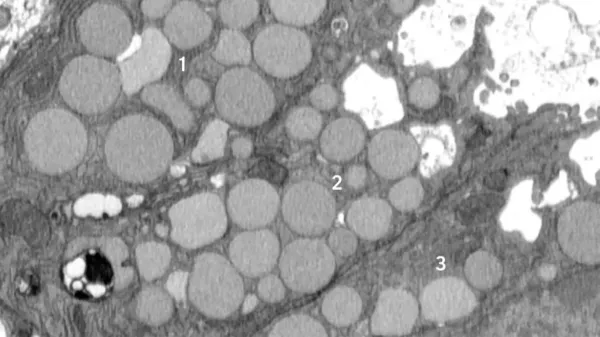 Cells “vomit” waste in a hidden…