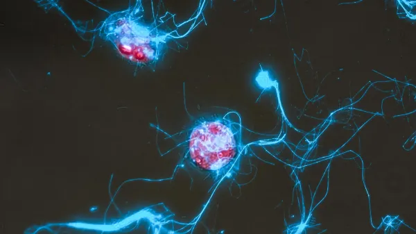 Glowing sugars show how microbes eat the…