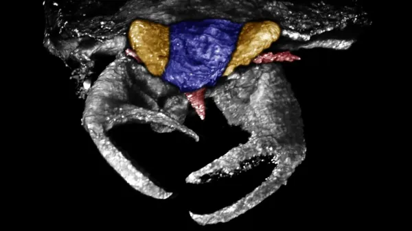 100-million-year-old bug had crab-like…