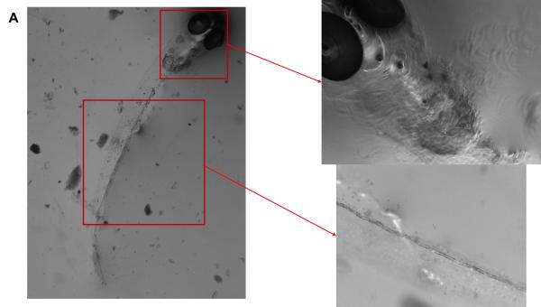 photo of Looking beyond microplastics: Cotton and synthetic microfibers impact behavior and growth of aquatic organisms image